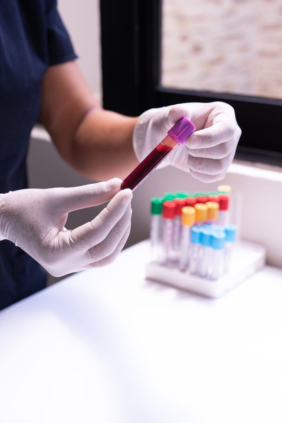 Lab technician examining blood sample tubes for autoimmune lab testing